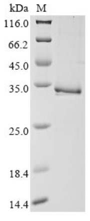 SDS PAGE (TPSB2-1488H).jpg